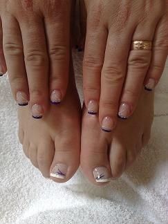 Galerie French Gel Füsse/ Prothesen &ndash; Beispielarbeit von PS-Nails & More