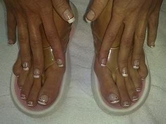 Galerie French Gel Füsse/ Prothesen &ndash; Beispielarbeit von PS-Nails & More